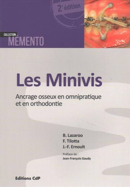 Les Minivis; Ancrage Osseux en Omnipratique et en Orthodontie 2e